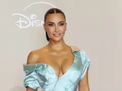 Kim Kardashian says she was diagnosed with a brain aneurysm